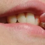 Come fare ad avere denti bianchi – segreto