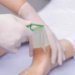 Come medicare le ferite fortemente essudanti