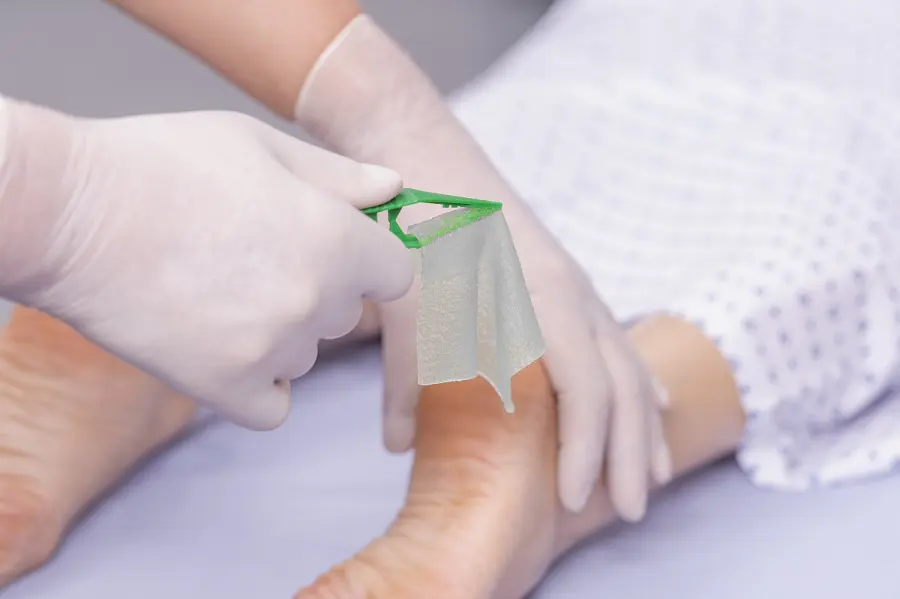 Come medicare le ferite fortemente essudanti