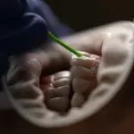 Come si cura la parodontite: cause, sintomi e rimedi