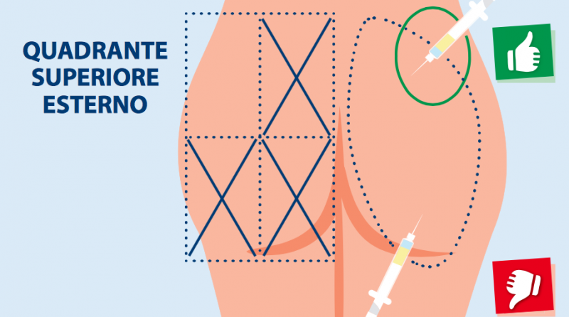Come fare correttamente una iniezione intramuscolare
