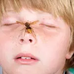 Puntura di vespa o di ape: che cosa fare?