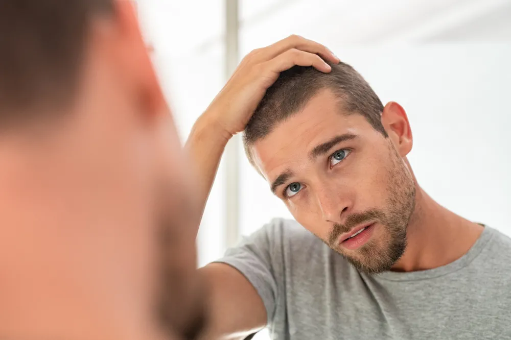 Come fare per contrastare la perdita dei capelli nell’uomo